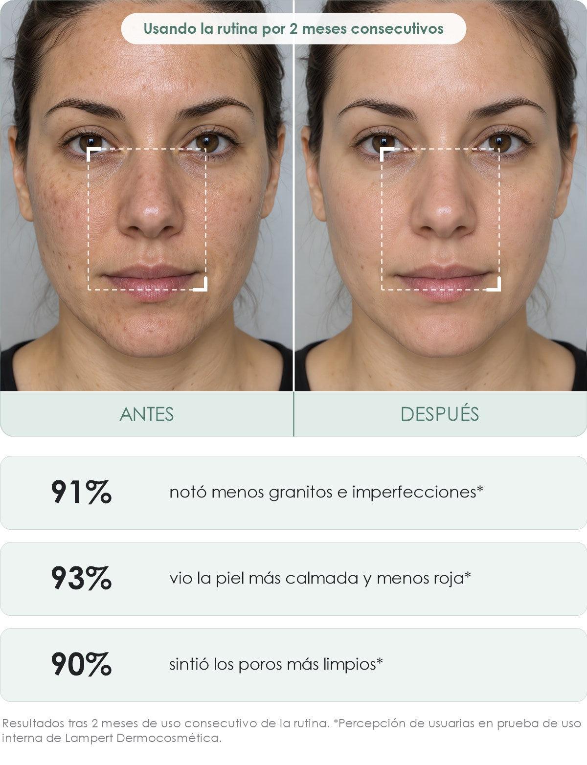 antiacne antes y después