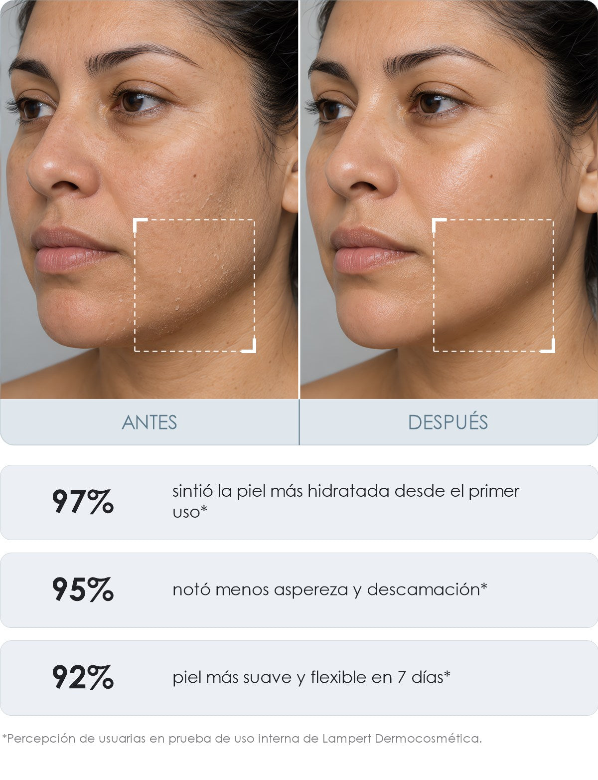 Antes y después con Crema Hidratante Lampert