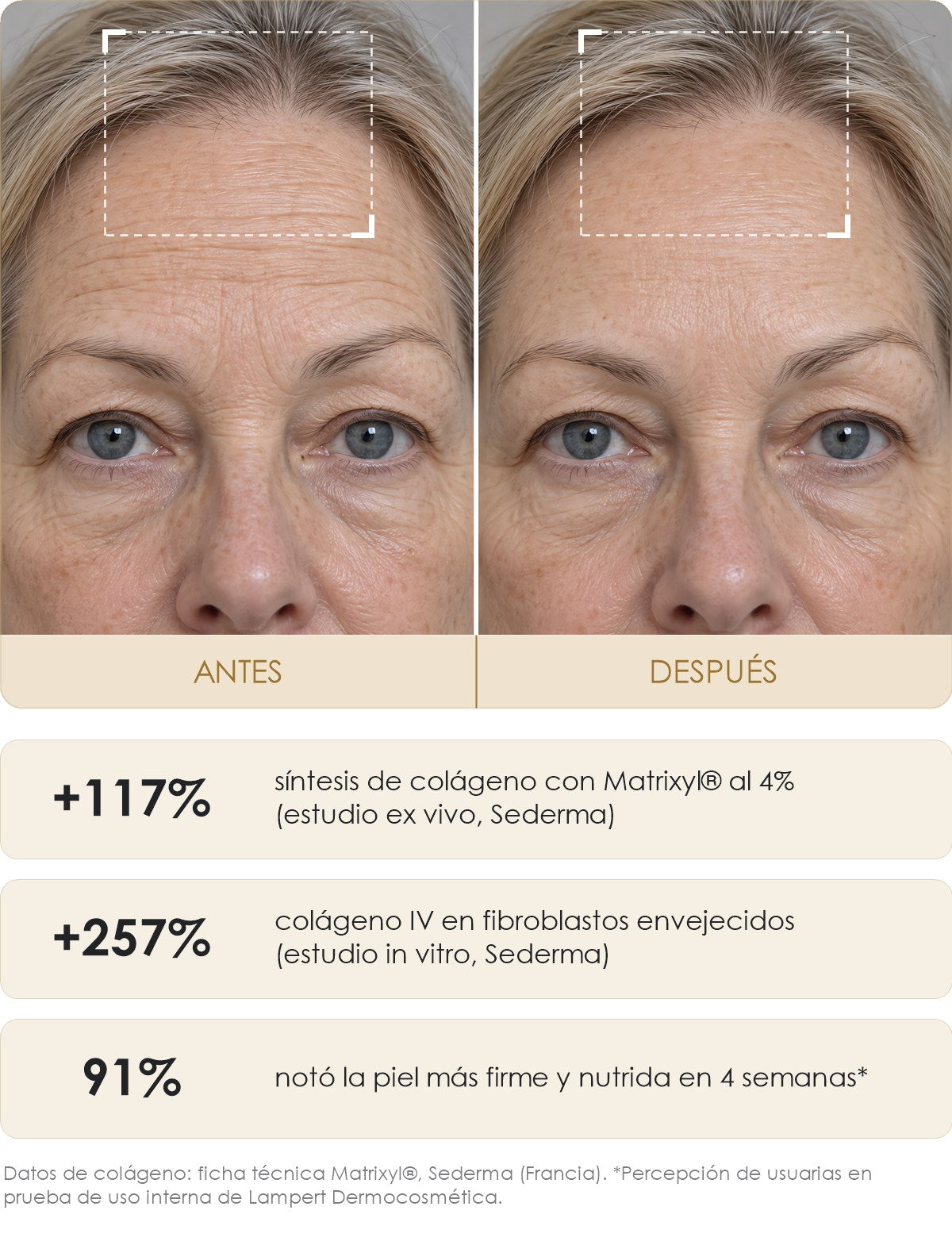 Antes y después con Crema Nutritiva Lampert