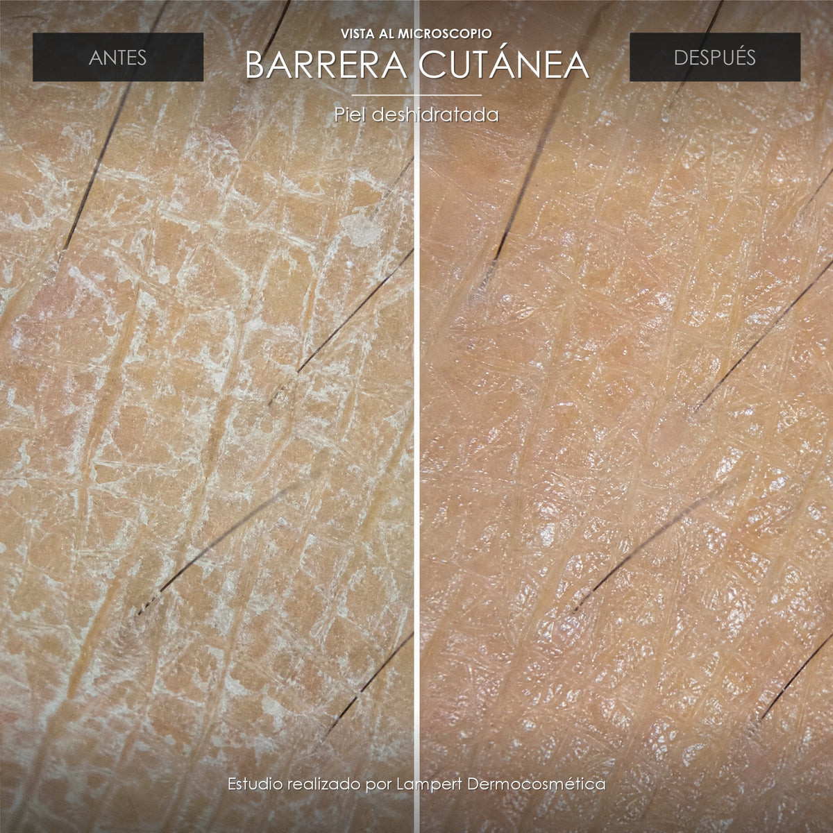 Vista al microscopio: barrera cutánea antes y después