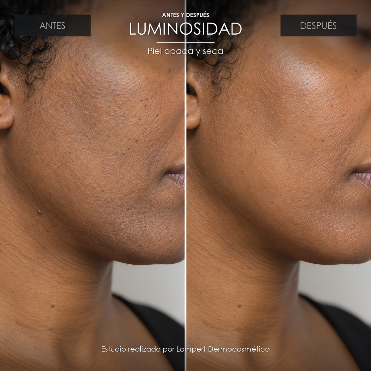 Antes y después: luminosidad de la piel