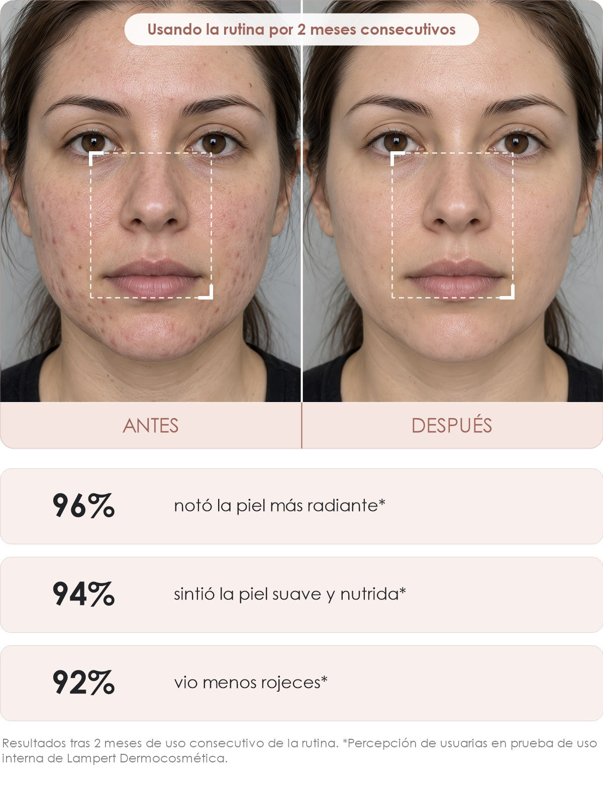 beauty antes y después