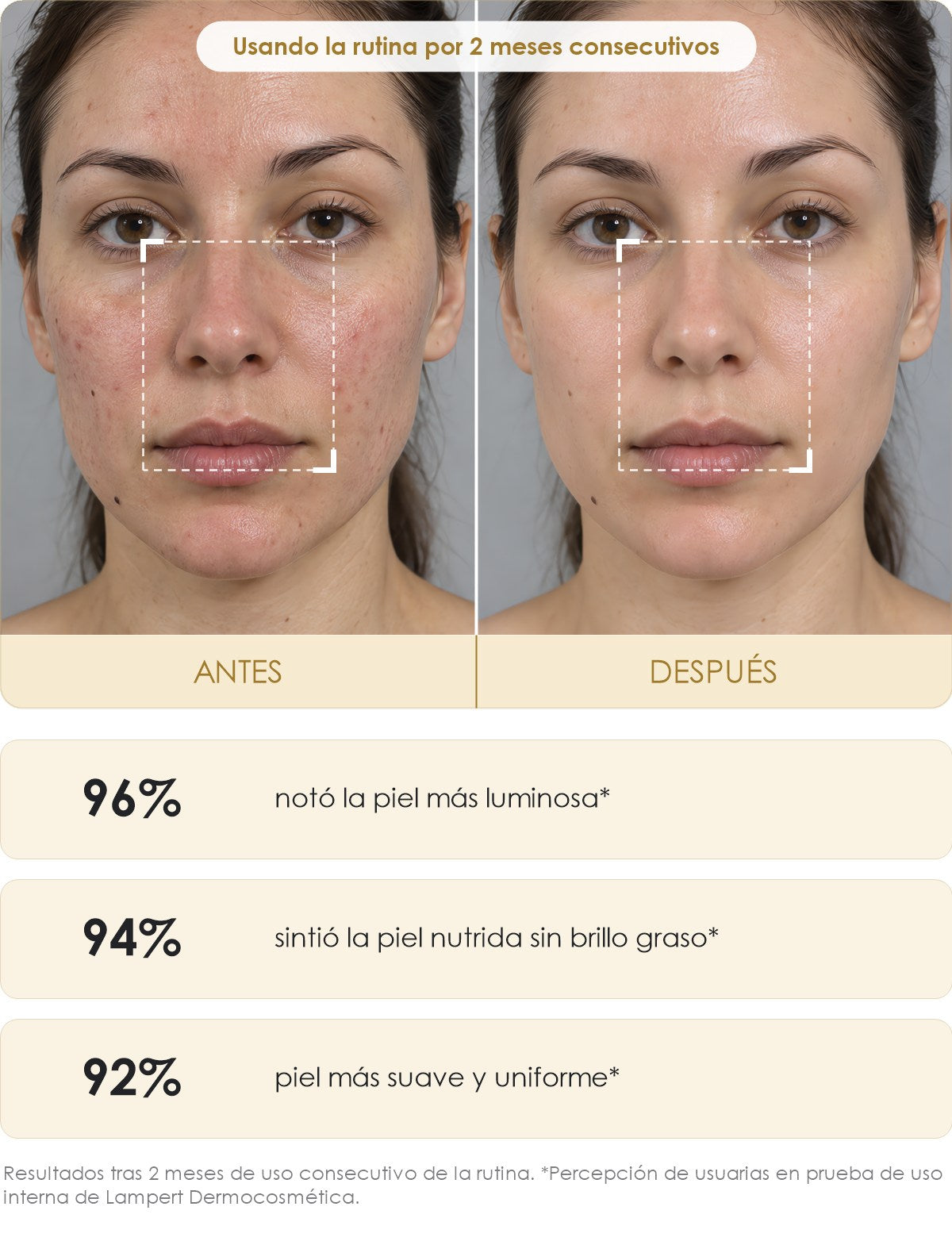 beauty2 antes y después