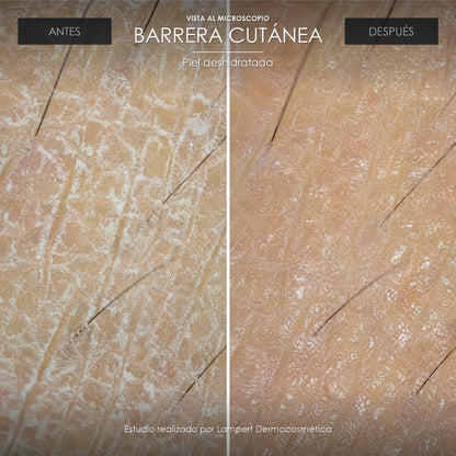 Vista al microscopio: barrera cutánea antes y después