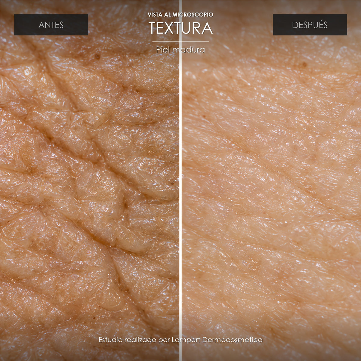 Vista al microscopio: textura de piel madura antes y después