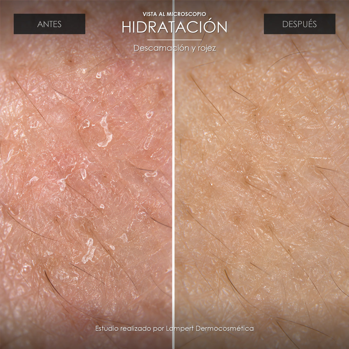 Vista al microscopio: hidratación antes y después